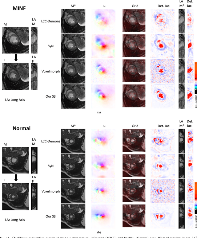 Figure 3 for Learning a Probabilistic Model for Diffeomorphic Registration