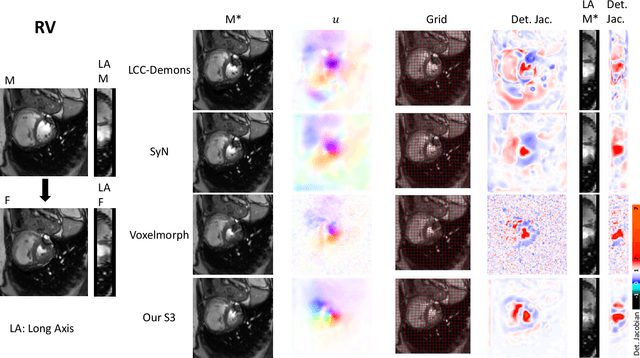 Figure 4 for Learning a Probabilistic Model for Diffeomorphic Registration