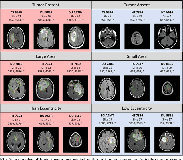 Figure 4 for Towards Emergent Language Symbolic Semantic Segmentation and Model Interpretability