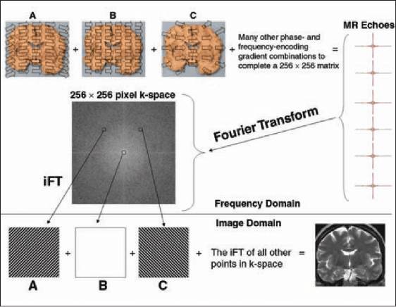 Figure 3 for Image Processing Techniques for identifying tumors in an MRI image