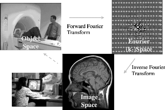 Figure 4 for Image Processing Techniques for identifying tumors in an MRI image