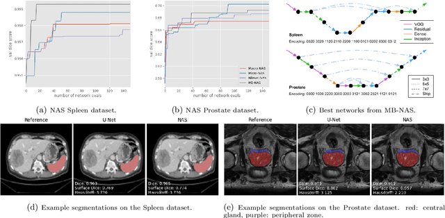 Figure 3 for Mixed-Block Neural Architecture Search for Medical Image Segmentation