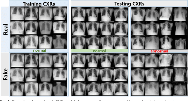 Figure 3 for Abnormal Chest X-ray Identification With Generative Adversarial One-Class Classifier