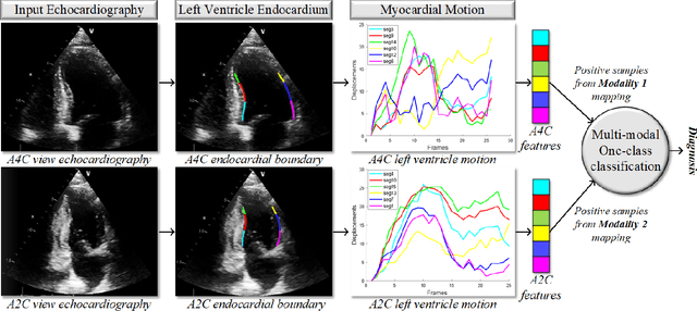Figure 1 for Early Myocardial Infarction Detection with One-Class Classification over Multi-view Echocardiography