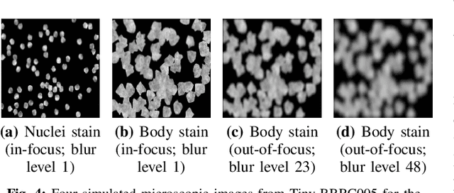 Figure 4 for Classification Beats Regression: Counting of Cells from Greyscale Microscopic Images based on Annotation-free Training Samples