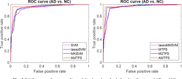 Figure 4 for ASMFS: Adaptive-Similarity-based Multi-modality Feature Selection for Classification of Alzheimer's Disease