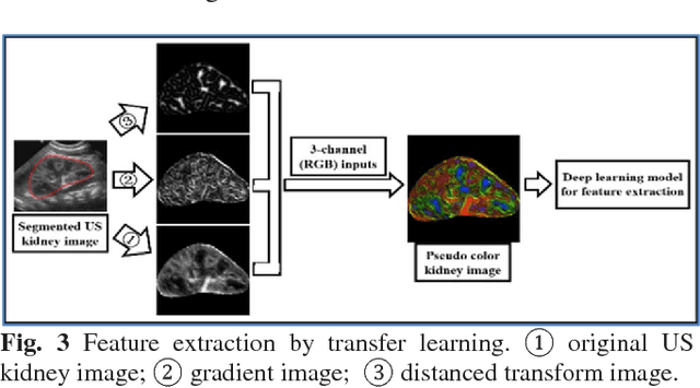 Figure 3 for Transfer learning for diagnosis of congenital abnormalities of the kidney and urinary tract in children based on Ultrasound imaging data