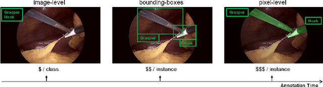 Figure 1 for Simulation-to-Real domain adaptation with teacher-student learning for endoscopic instrument segmentation