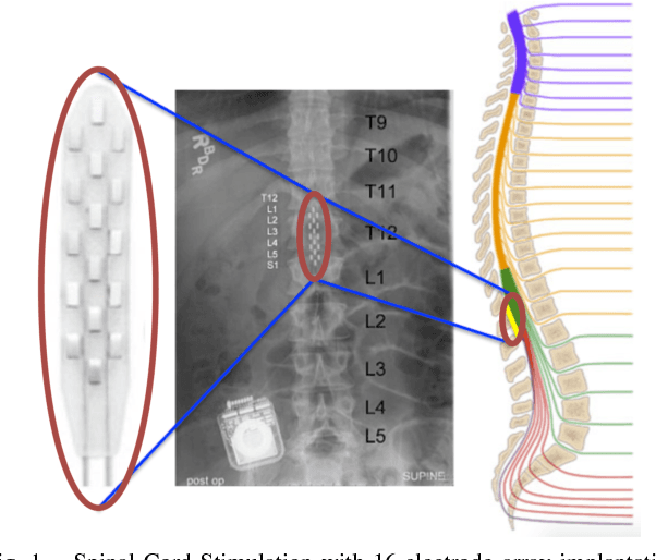 Figure 1 for Quantifying Performance of Bipedal Standing with Multi-channel EMG