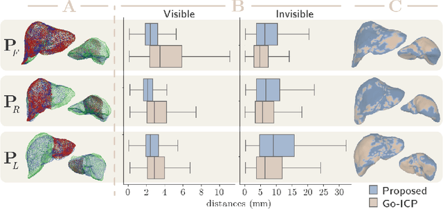 Figure 3 for Intraoperative Liver Surface Completion with Graph Convolutional VAE