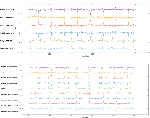 Figure 4 for Fetal ECG Extraction from Maternal ECG using attention-based Asymmetric CycleGAN