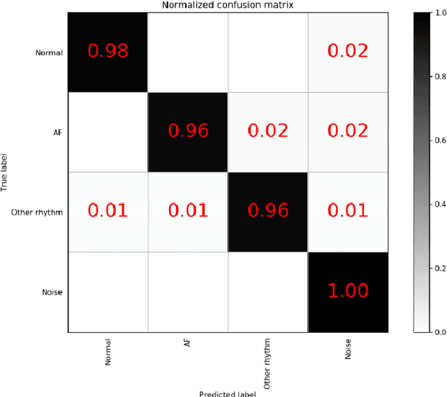 Figure 3 for Method of diagnosing heart disease based on deep learning ECG signal