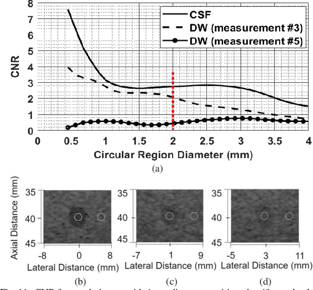 Figure 3 for Coded Divergent Waves for Fast Ultrasonic Imaging: Optimization and Comparative Performance Analysis
