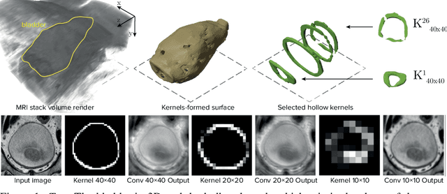 Figure 1 for Learnable Hollow Kernels for Anatomical Segmentation