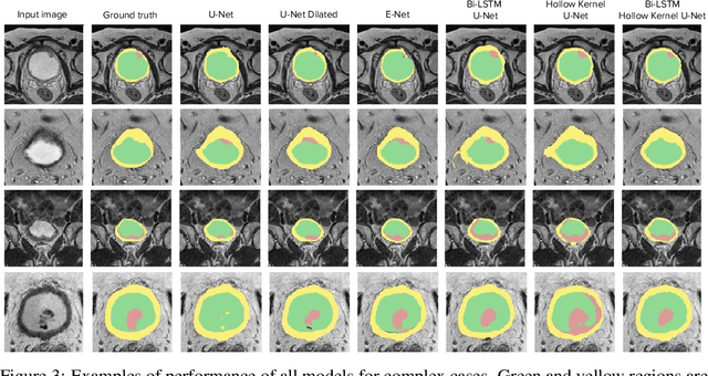 Figure 4 for Learnable Hollow Kernels for Anatomical Segmentation