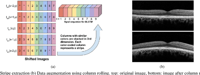 Figure 2 for A deep learning framework for segmentation of retinal layers from OCT images