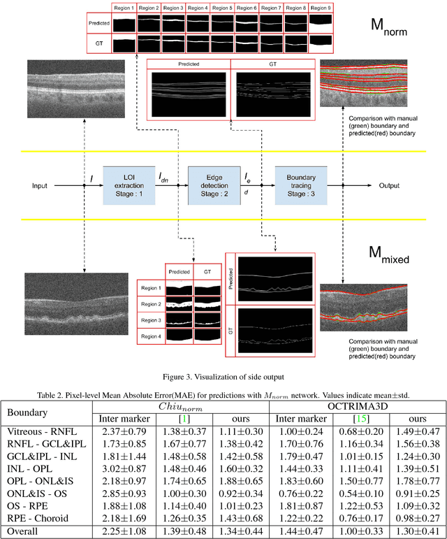 Figure 3 for A deep learning framework for segmentation of retinal layers from OCT images