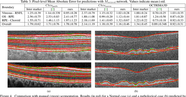 Figure 4 for A deep learning framework for segmentation of retinal layers from OCT images