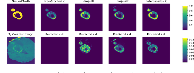 Figure 1 for Towards safe deep learning: accurately quantifying biomarker uncertainty in neural network predictions