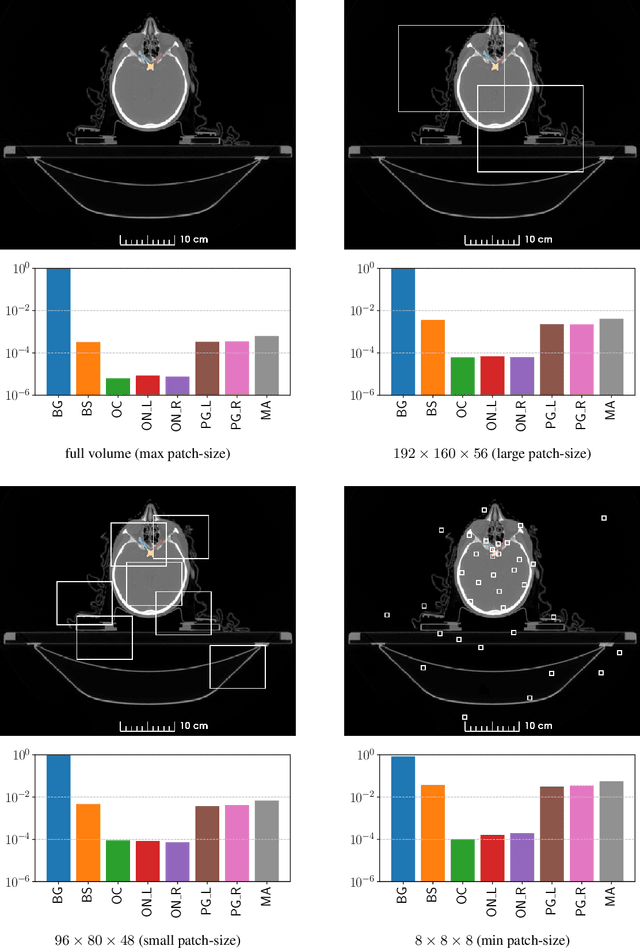 Figure 1 for Tackling the Class Imbalance Problem of Deep Learning Based Head and Neck Organ Segmentation