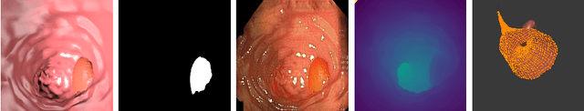 Figure 1 for Synthetic data for unsupervised polyp segmentation