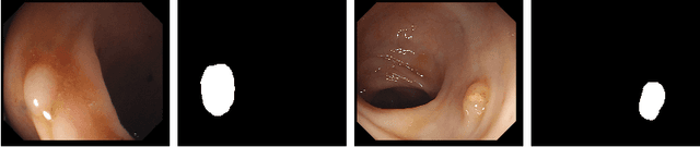 Figure 3 for Synthetic data for unsupervised polyp segmentation