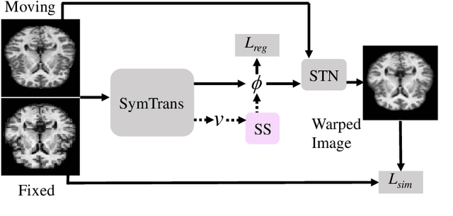 Figure 1 for Symmetric Transformer-based Network for Unsupervised Image Registration