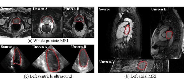 Figure 1 for When Unseen Domain Generalization is Unnecessary? Rethinking Data Augmentation
