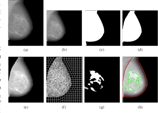 Figure 3 for Deep-LIBRA: Artificial intelligence method for robust quantification of breast density with independent validation in breast cancer risk assessment