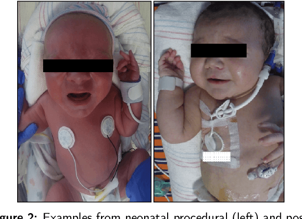 Figure 3 for Multimodal Spatio-Temporal Deep Learning Approach for Neonatal Postoperative Pain Assessment