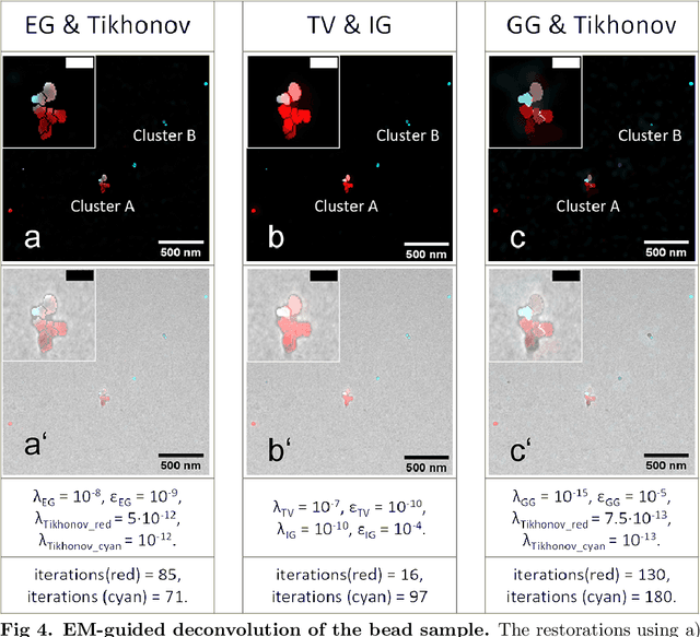 Figure 4 for Guided-deconvolution for Correlative Light and Electron Microscopy