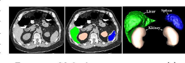 Figure 2 for Holographic Visualisation of Radiology Data and Automated Machine Learning-based Medical Image Segmentation