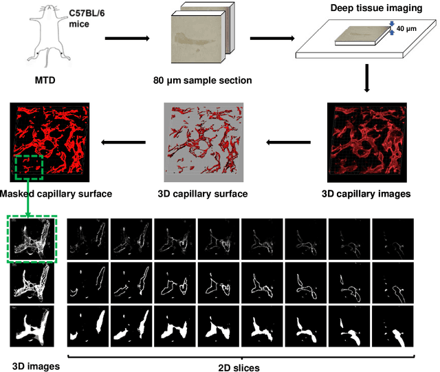 Figure 1 for Immunofluorescence Capillary Imaging Segmentation: Cases Study