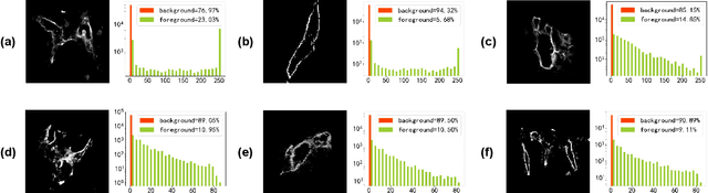 Figure 3 for Immunofluorescence Capillary Imaging Segmentation: Cases Study
