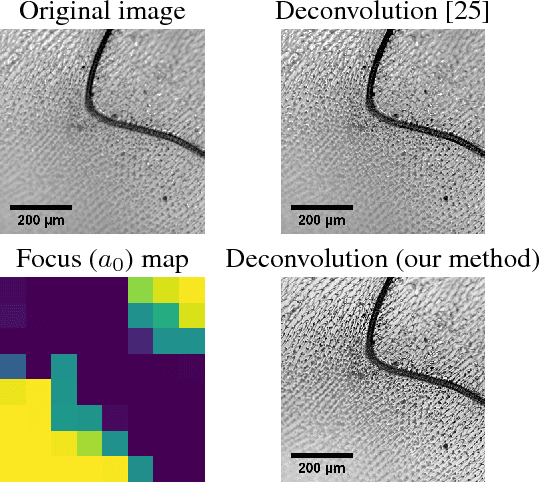 Figure 4 for Semi-Blind Spatially-Variant Deconvolution in Optical Microscopy with Local Point Spread Function Estimation By Use Of Convolutional Neural Networks