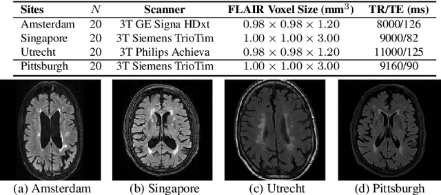 Figure 3 for Robust White Matter Hyperintensity Segmentation on Unseen Domain