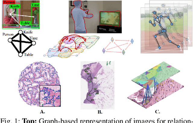 Figure 1 for A Survey on Graph-Based Deep Learning for Computational Histopathology