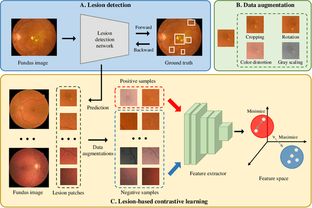 Figure 3 for Lesion-based Contrastive Learning for Diabetic Retinopathy Grading from Fundus Images