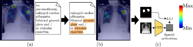 Figure 1 for Localization supervision of chest x-ray classifiers using label-specific eye-tracking annotation