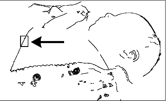 Figure 2 for Non-contact Infant Sleep Apnea Detection