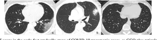 Figure 3 for Deep Neural Networks for COVID-19 Detection and Diagnosis using Images and Acoustic-based Techniques: A Recent Review