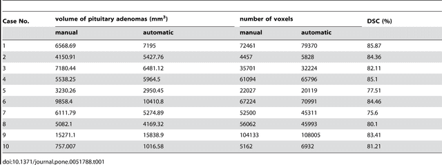 Figure 2 for Pituitary Adenoma Volumetry with 3D Slicer