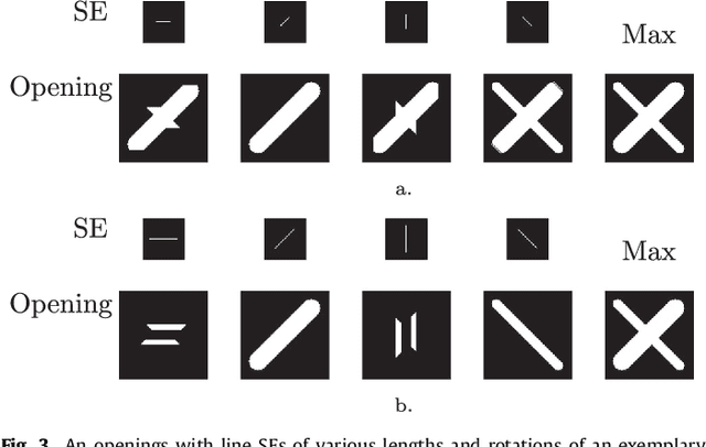 Figure 4 for The Multiscale Bowler-Hat Transform for Blood Vessel Enhancement in Retinal Images
