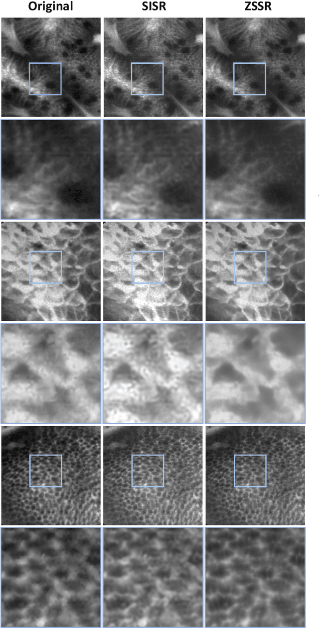 Figure 4 for Zero-shot super-resolution with a physically-motivated downsampling kernel for endomicroscopy
