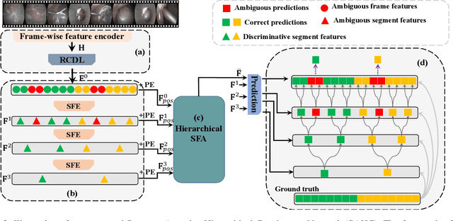 Figure 3 for Exploiting Segment-level Semantics for Online Phase Recognition from Surgical Videos