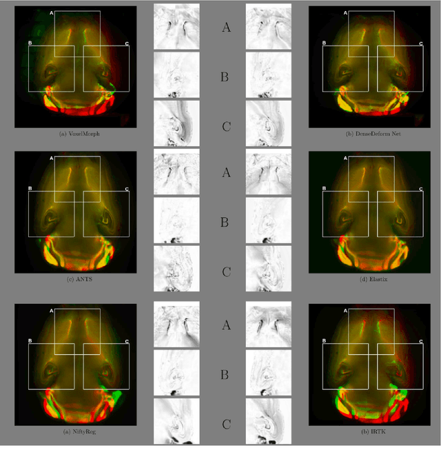 Figure 2 for Dense Deformation Network for High Resolution Tissue Cleared Image Registration