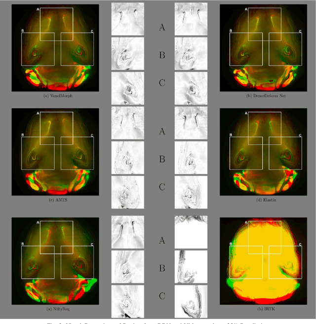 Figure 3 for Dense Deformation Network for High Resolution Tissue Cleared Image Registration