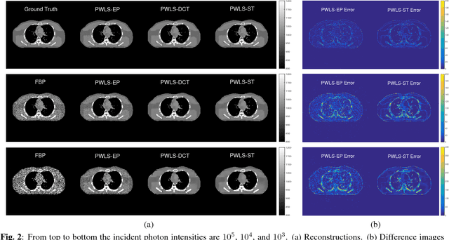 Figure 3 for Low Dose CT Image Reconstruction With Learned Sparsifying Transform
