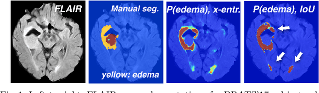 Figure 1 for Ensembles of Multiple Models and Architectures for Robust Brain Tumour Segmentation