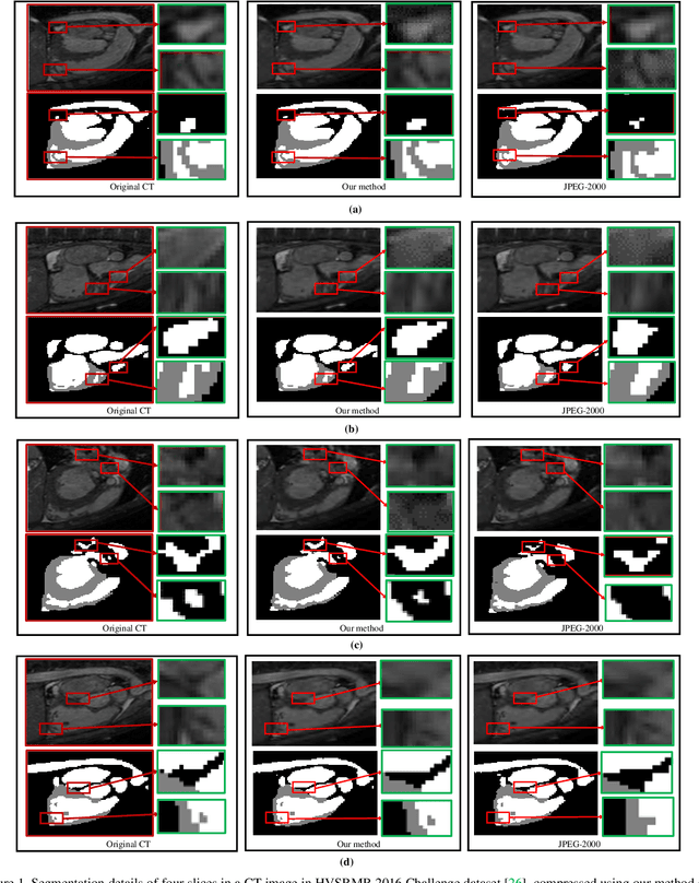 Figure 1 for Machine Vision Guided 3D Medical Image Compression for Efficient Transmission and Accurate Segmentation in the Clouds